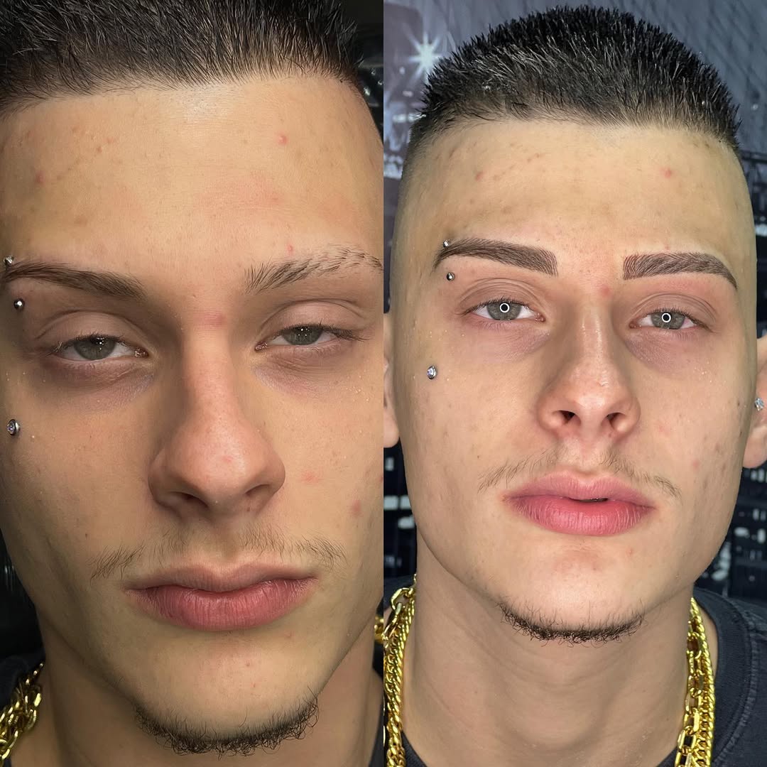 Antes e depois de micropigmentação de sobrancelha masculina