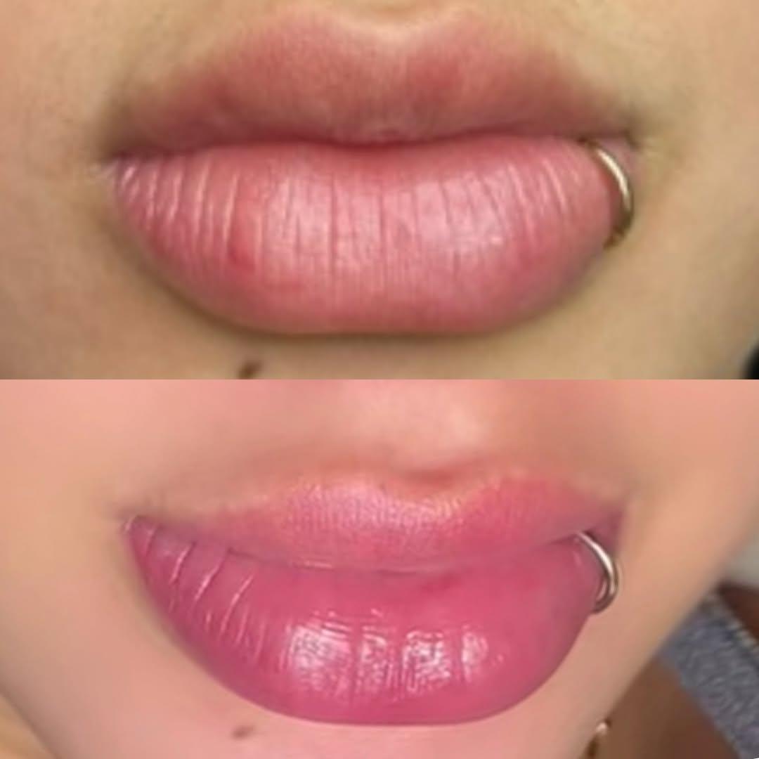 Antes e depois de micropigmentação labial já cicatrizada